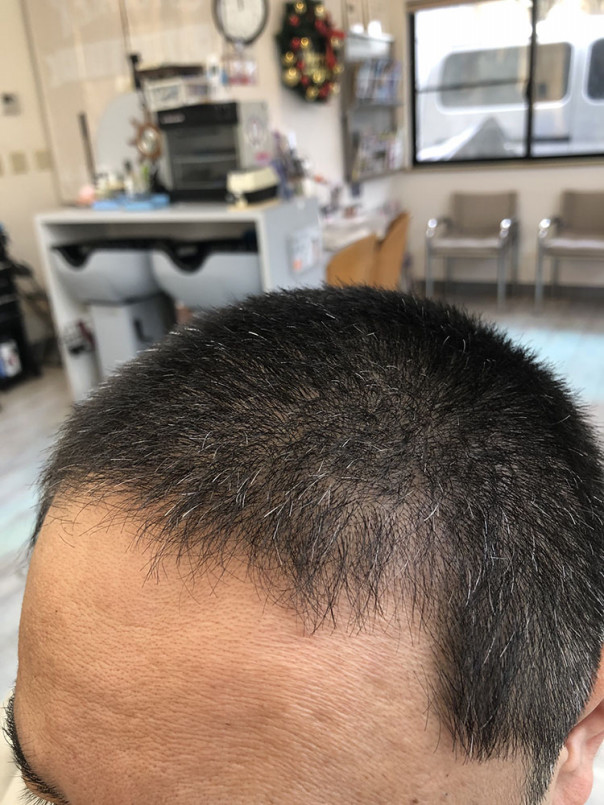 短すぎない長めの丸刈り 15mm カットスペース K Barber Shop 横浜市港南区の理容室 上永谷と下永谷の中間地にある理髪店です フェードカットやスキンフェードなどのメンズカットに定評あり 駐車場２台分完備