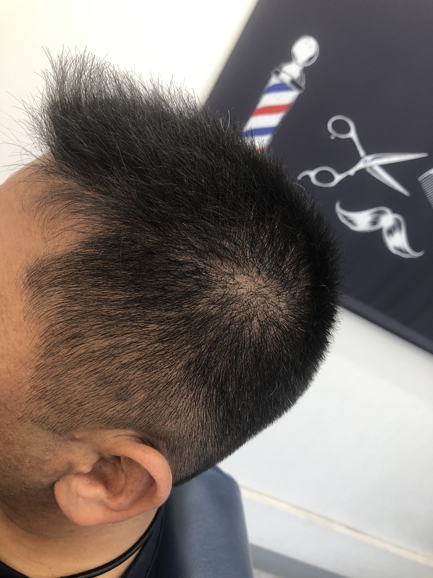 フェードカット 3mm 季節に合わせた刈り高 カットスペース K Barber Shop 横浜市港南区の理容室 上永谷と下永谷の中間地にある理髪店です フェードカットやスキンフェードなどのメンズカットに定評あり 駐車場２台分完備