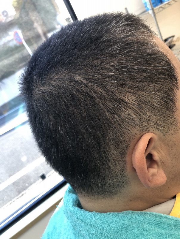 長めの丸刈り 15ミリ 柔らかいシルエット カットスペース K Barber Shop 横浜市港南区の理容室 上永谷と下永谷の中間地にある理髪店です フェードカットやスキンフェードなどのメンズカットに定評あり 駐車場２台分完備