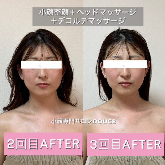 買う スキニー 抑制 1 週間 小 顔 マッサージ Daisy Daisy Daisy Jp