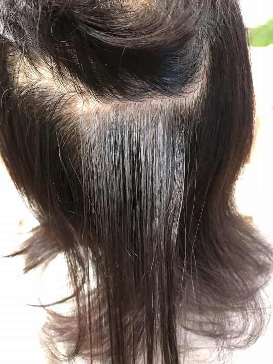頭皮のベタつき気になりませんか Hair Studio Light なるみ 頭皮のベタつき気になりませんか Hair Studio Light なるみ