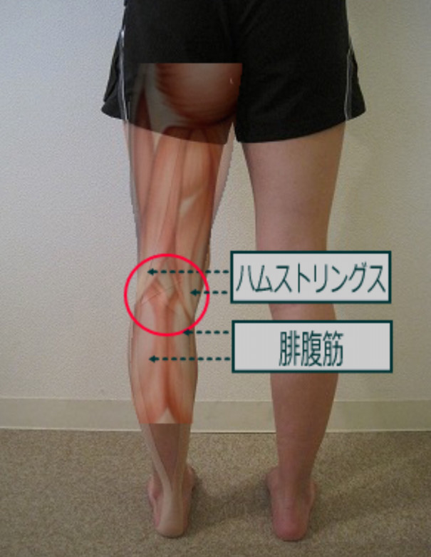 最近の私 膝の裏の痛み Fit Insole 最近の私 膝の裏の痛み Fit Insole