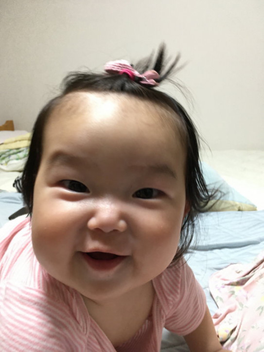 白斑 血豆 突然の痛み まんまる助産院 出張訪問の母乳相談室 白斑 血豆 突然の痛み まんまる助産院 出張訪問の母乳相談室