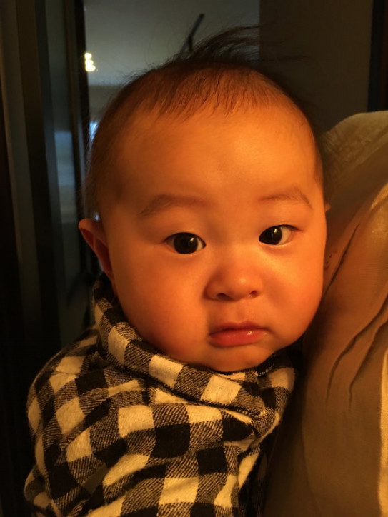 おっぱいが急に張って痛みが出てきた 白斑 まんまる助産院 出張訪問の母乳相談室