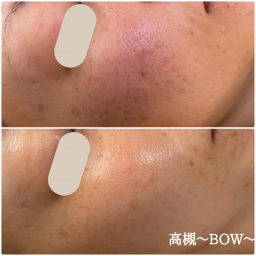 値下げDOCスキンケア　6番　ブライトアップクリーム　新品未使用　限定値下げ DOC Skincare | 美容商材ならAマーケット！