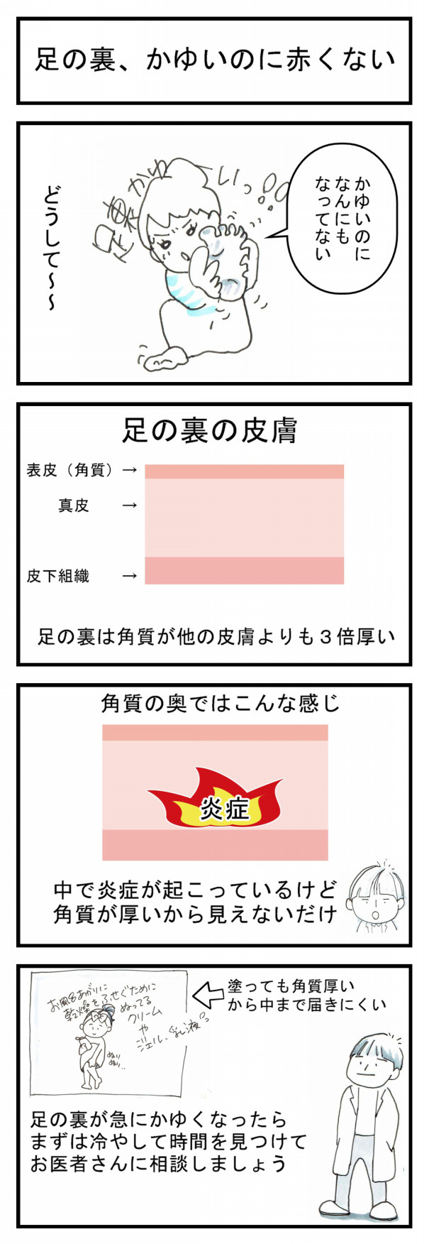 足の裏がかゆい かゆいのに赤くない 部位別かゆみ研究所 みやこ内科クリニック