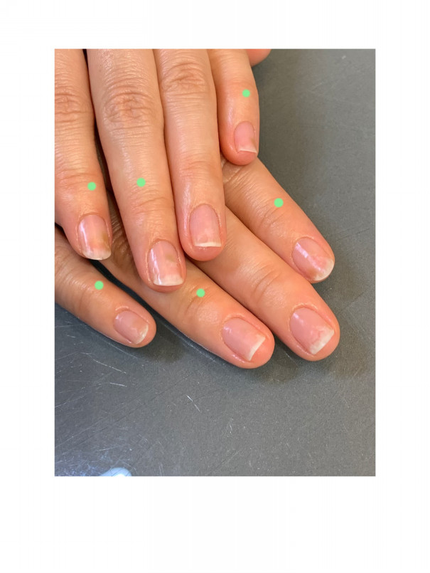 緑膿菌感染 ネイルトラブル Uknail Salon School For Nail Skin