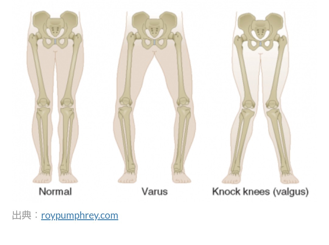 ｘ脚って 大人フィギュアスケーター向けオフアイストレーニング ボディスタイリング Athbody Training アスボディトレーニング
