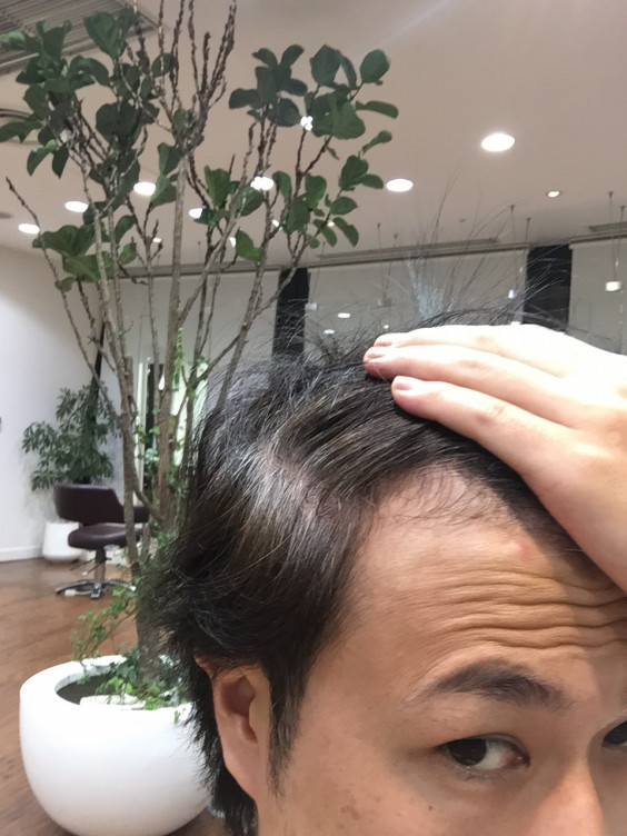 白髪染めでやってはいけない事 Takashi