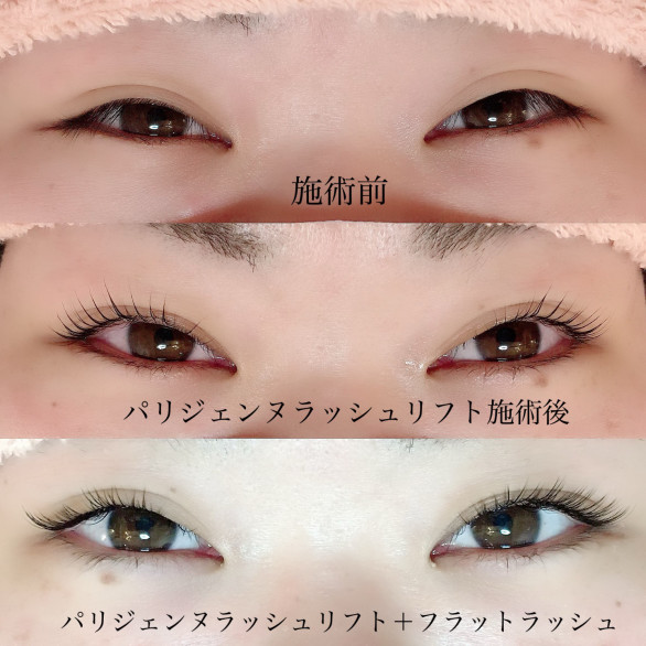 まつげエステ Ameba Ownd