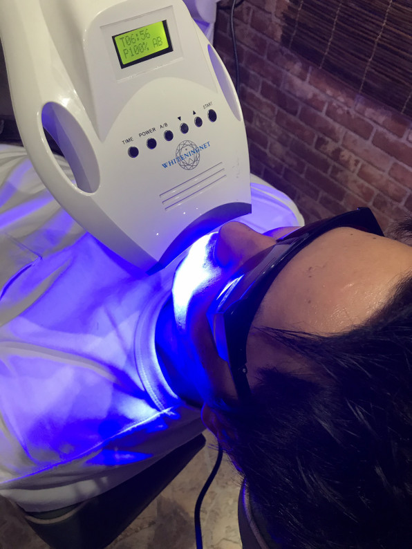 超人気のセルフホワイトニング 帯広でカラオケのできる美容室 隠れ家salon ぽとす