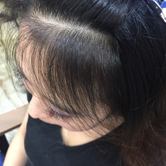 湿気や汗でふわふわする髪にお悩みの方 和歌山市 美容室 Aohair アオヘアー さこはた大輔 のブログ