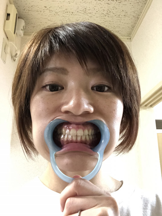 セルフホワイトニング?って⁉️ | 〜Reposer〜ルポゼ