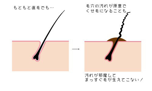 くせ毛は何故ウネる 美容室 Ash 鷺沼店 ブログ