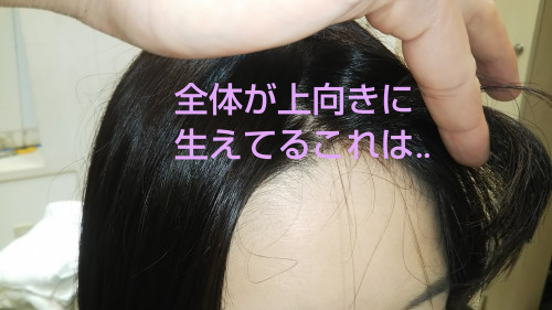 難易度別生えグセの種類 美容室 Ash 八幡山店 ブログ 難易度別生えグセの種類 美容室 Ash 八幡山店 ブログ