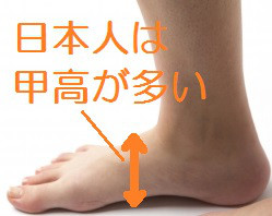 ランナーに多い足のトラブル 足の甲の痛み 足圧宗家