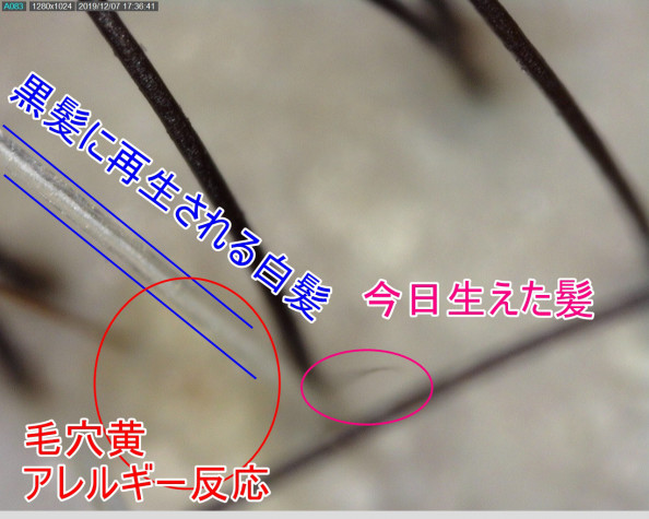 体質改善の育毛とは 体質改善 若返りの育毛美容室 頭皮博士おのれいこ