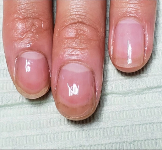 深爪をどうにかしたい方へ Toiro Nails