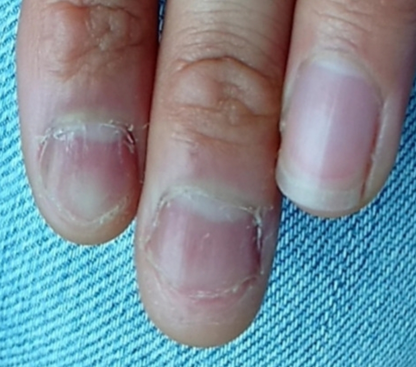 深爪をどうにかしたい方へ Toiro Nails