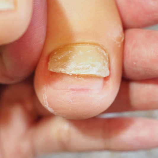 足の爪は大事 Tocotoco Nail