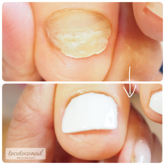 足の爪は大事 Tocotoco Nail 足の爪は大事 Tocotoco Nail