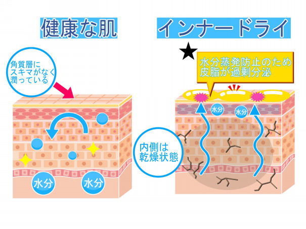 乾燥肌とは Atelier De Beaute Sophia 乾燥肌とは Atelier De Beaute Sophia