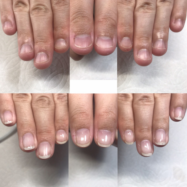 爪育事例 指先から人生に彩りを あなたの理想を叶えるネイルサロン Nail Nana