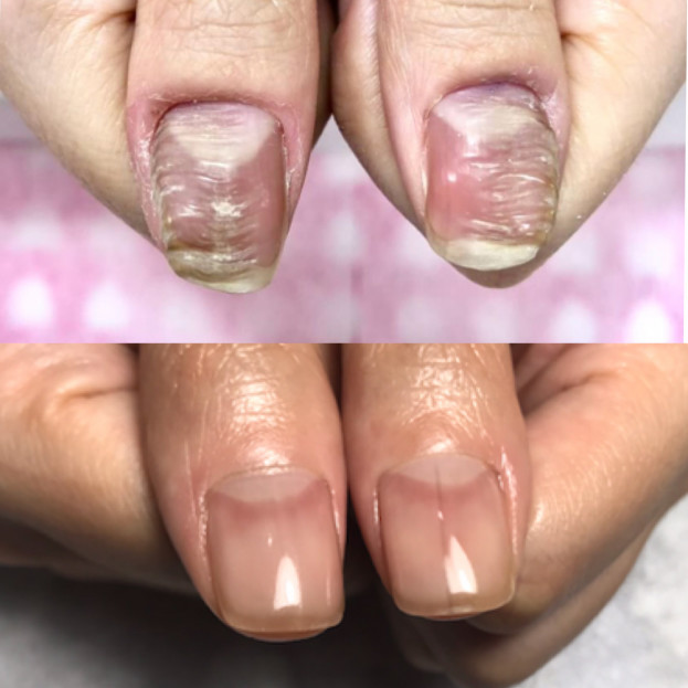 爪育事例 指先から人生に彩りを あなたの理想を叶えるネイルサロン Nail Nana