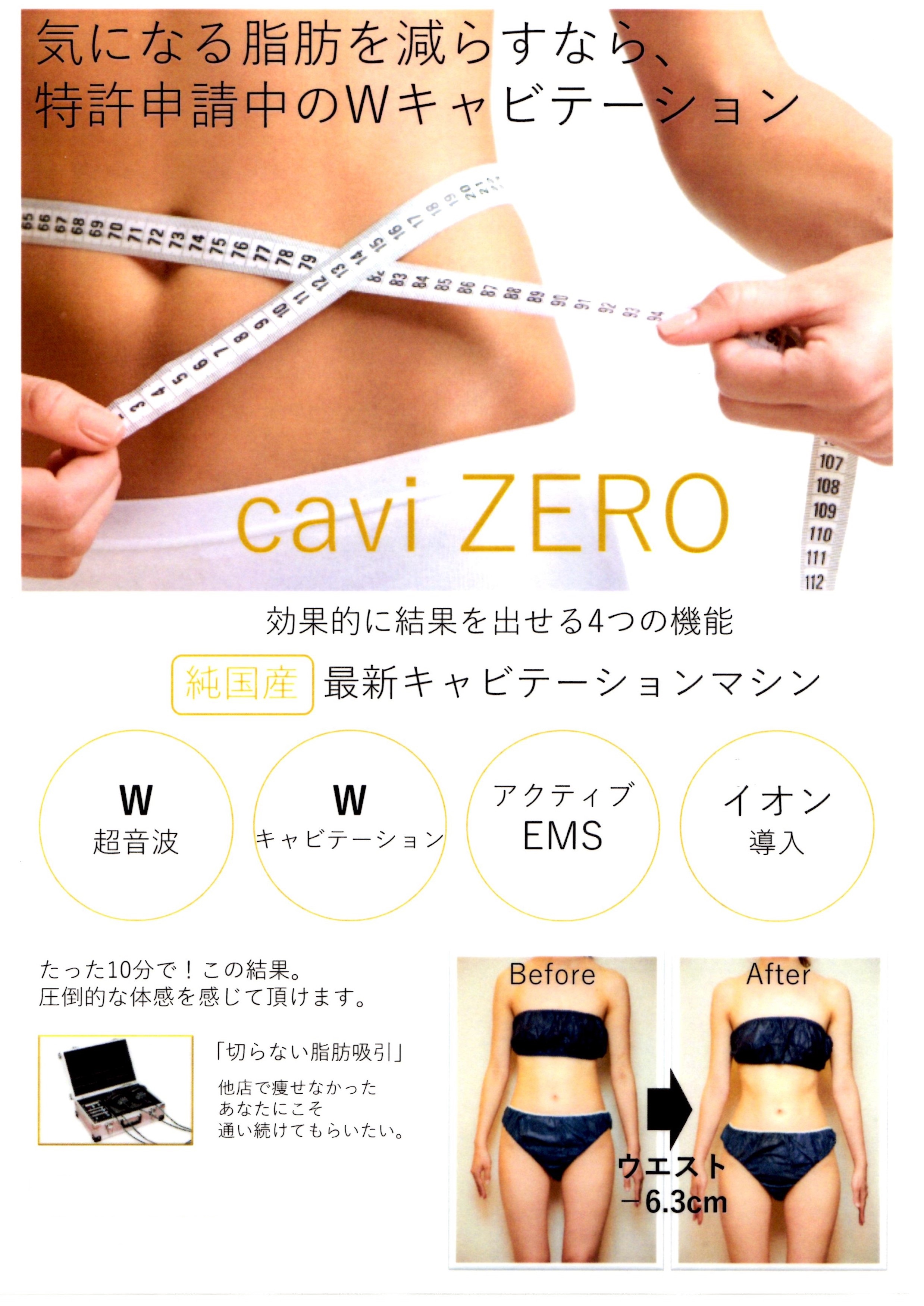 cavi ZERO キャビゼロ　キャビテーション　EMS