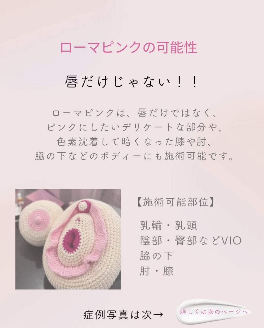ローマピンクとは？ | Mahana