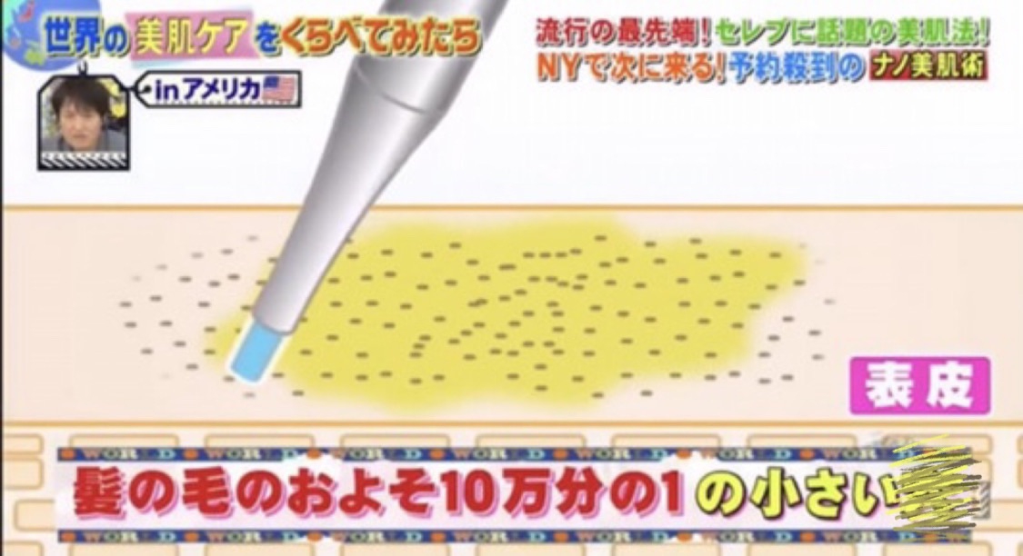 アメリカで話題の！エステ版ダーマペン リゼネレート - 美容機器