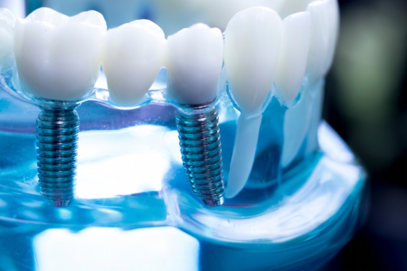 東京駅周辺でインプラント治療が受けられるクリニック Esthetic Dentistry