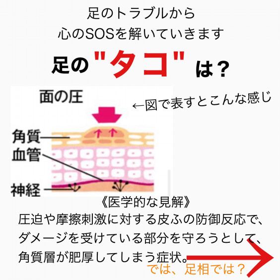 足の タコ が表す心の状態とは 余計なものは使わない 原液salon