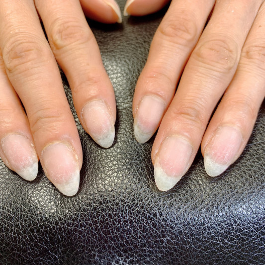 お爪周りの角質ケア 仕上がりまで Reve