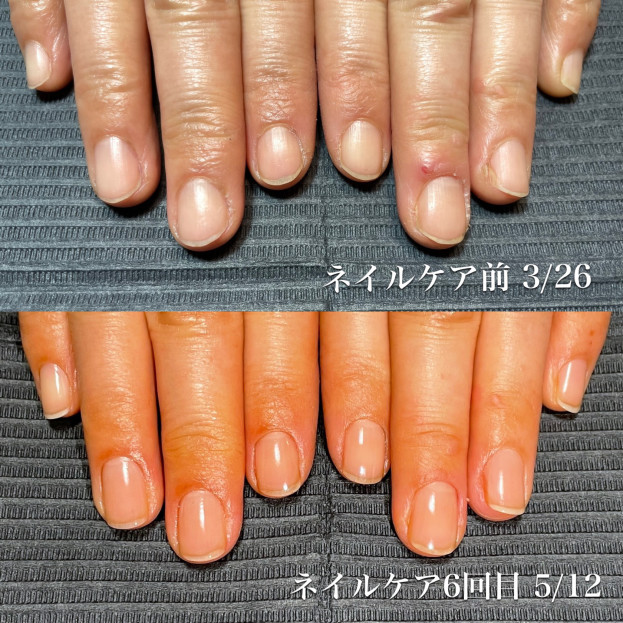 地爪育成 最強のネイルケアメソッド 愛知県江南市ネイルサロン スクール マルベリー和田幸代 S Ownd