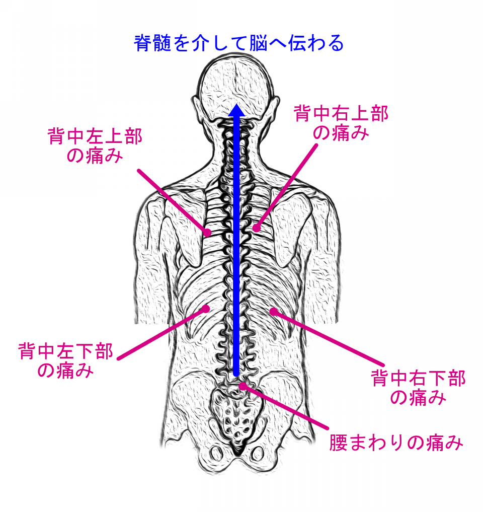 痛い 右上 背中 ぎっくり背中とは？急な背中の痛みの原因・注意すべき日常動作 [骨・筋肉・関節の病気]