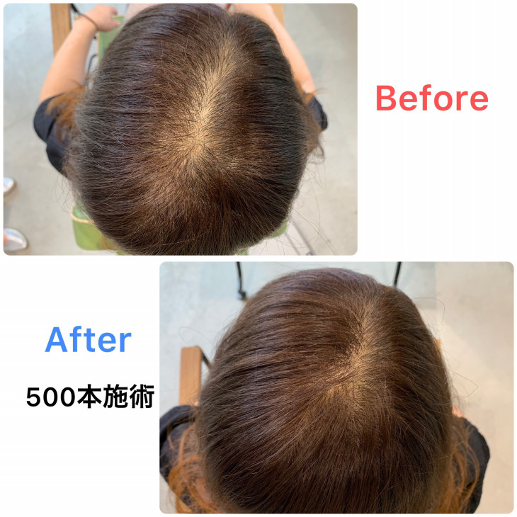 増毛 500本ってどれくらい 大人のエクステ ふわり