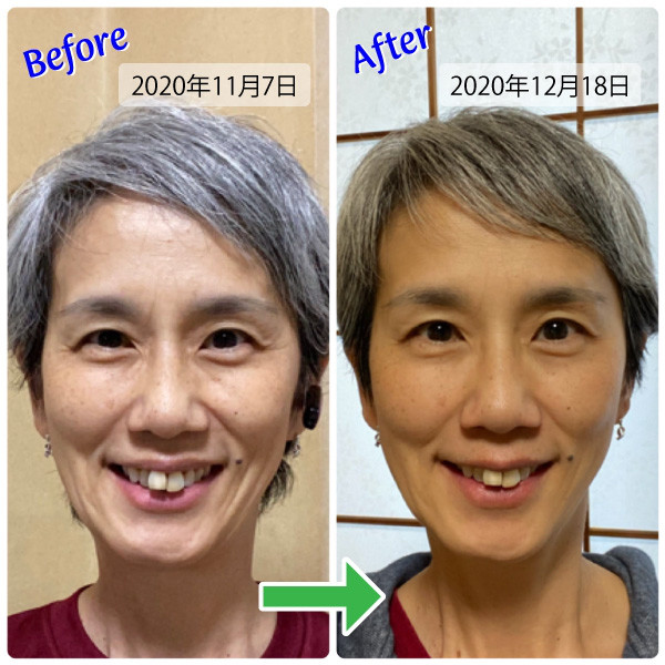 21年1月から 顔ヨガ 始めます Nyoga 乳がんを体験された方onlyのヨガ