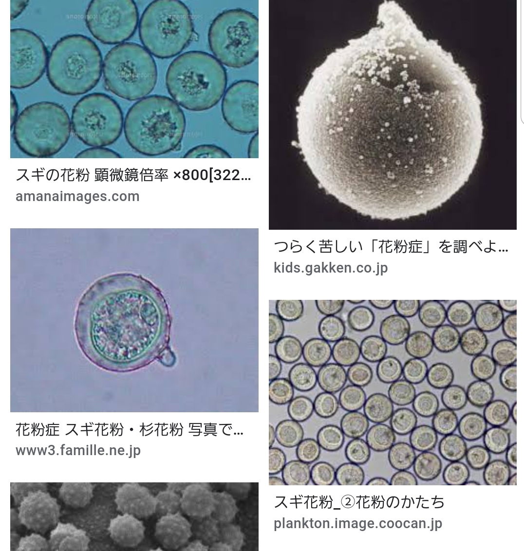 花粉飛散 スギ ヒノキ 医療法人社団誠心会 あすみが丘耳鼻咽喉科 気管食道科