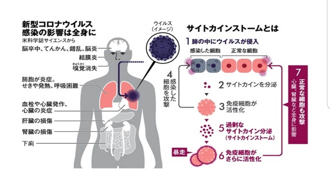 新型コロナの怖さ | 医療法人社団誠心会 あすみが丘耳鼻咽喉科