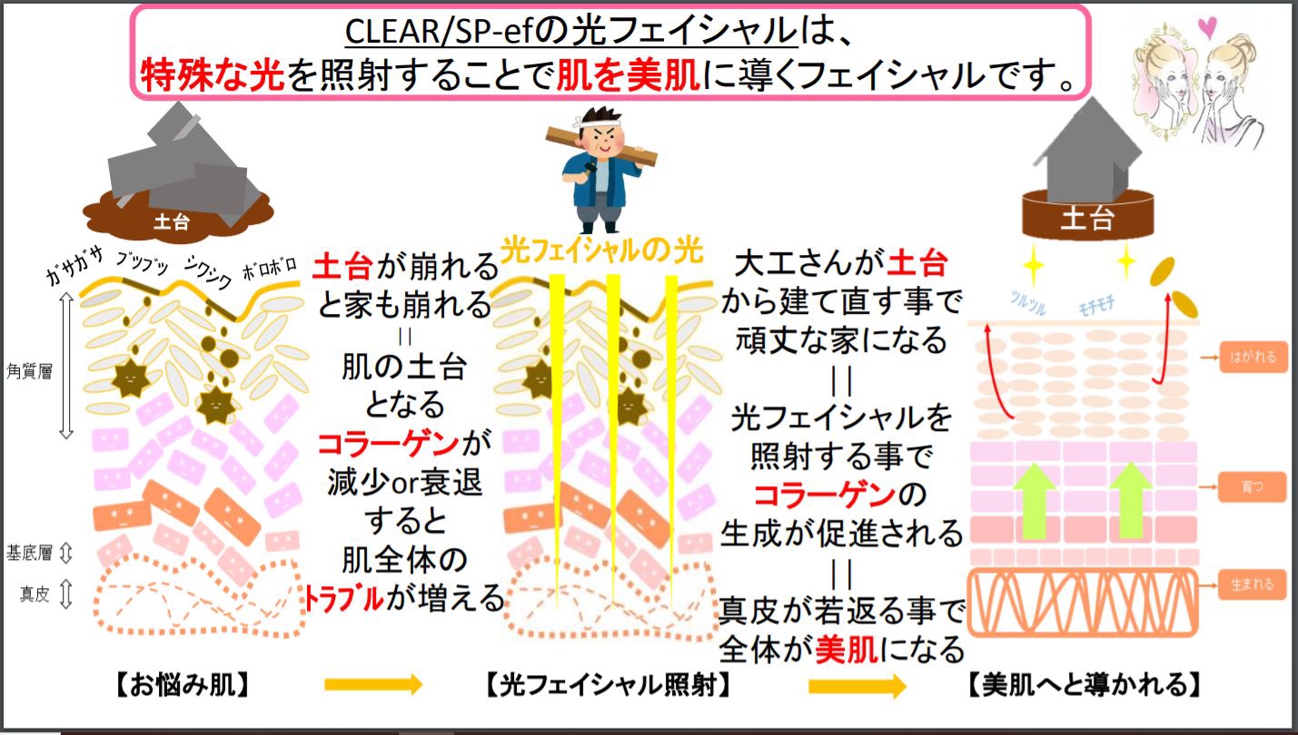 光フェイシャルエステはじめます 脱毛サロン Moi