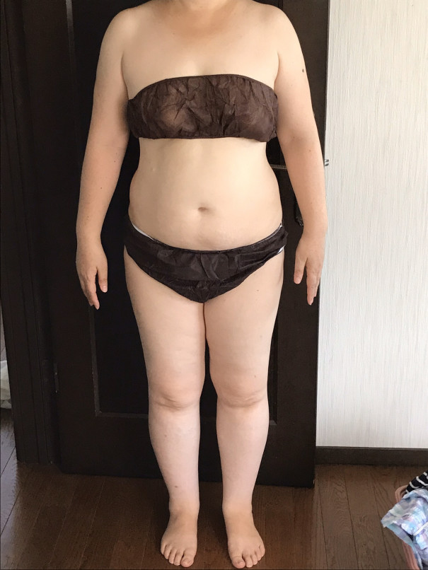 私のダイエット6か月の変化を写真で 体質改善ダイエット Hbb