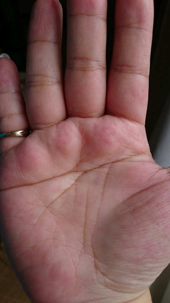 両手ますかけ線 結婚相談所 結 マリアージュ