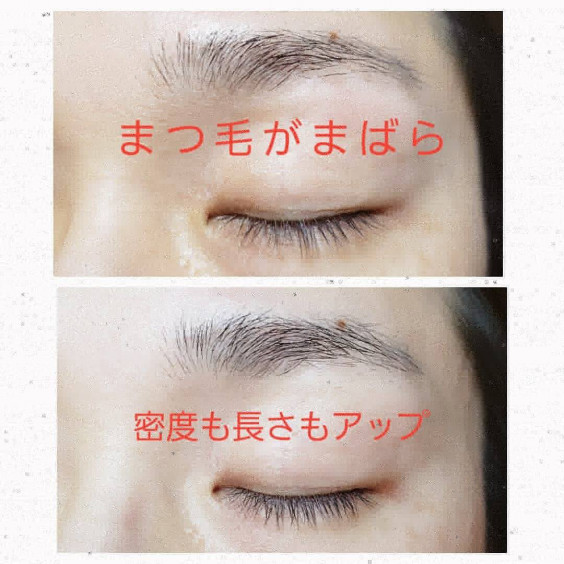 11月末まで Vediteモニター募集終了のお知らせ Hair Aesthe ヘアドネーションのsatisfeal