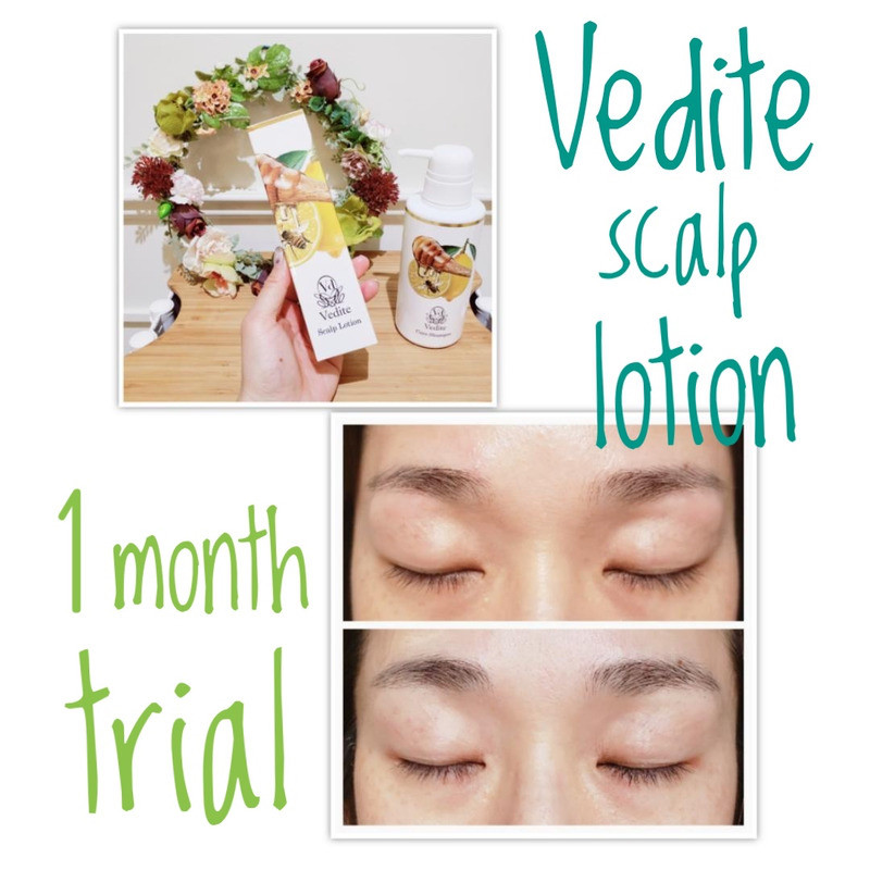 Vediteで眉毛 まつ毛も 育毛アプローチ Hair Aesthe ヘアドネーションのsatisfeal
