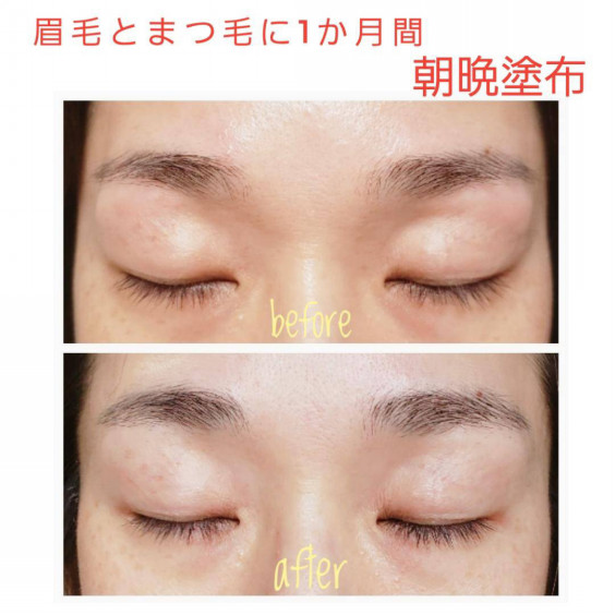 11月末まで Vediteモニター募集終了のお知らせ Hair Aesthe ヘアドネーションのsatisfeal 11月末まで Vediteモニター募集終了のお知らせ Hair Aesthe ヘアドネーションのsatisfeal