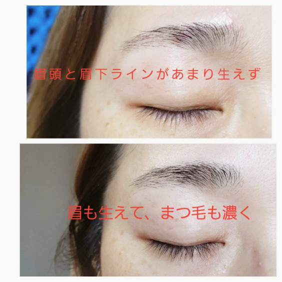 11月末まで Vediteモニター募集終了のお知らせ Hair Aesthe ヘアドネーションのsatisfeal 11月末まで Vediteモニター募集終了のお知らせ Hair Aesthe ヘアドネーションのsatisfeal