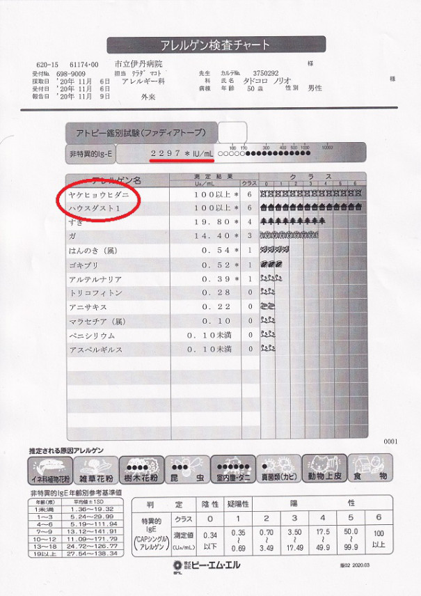 市立伊丹病院でアレルギーの値 通常の花粉症の約7 5倍 薬価６万円もする最終兵器のお注射治療薬登場 Netwingsj ネットウイングス Netwings Jp