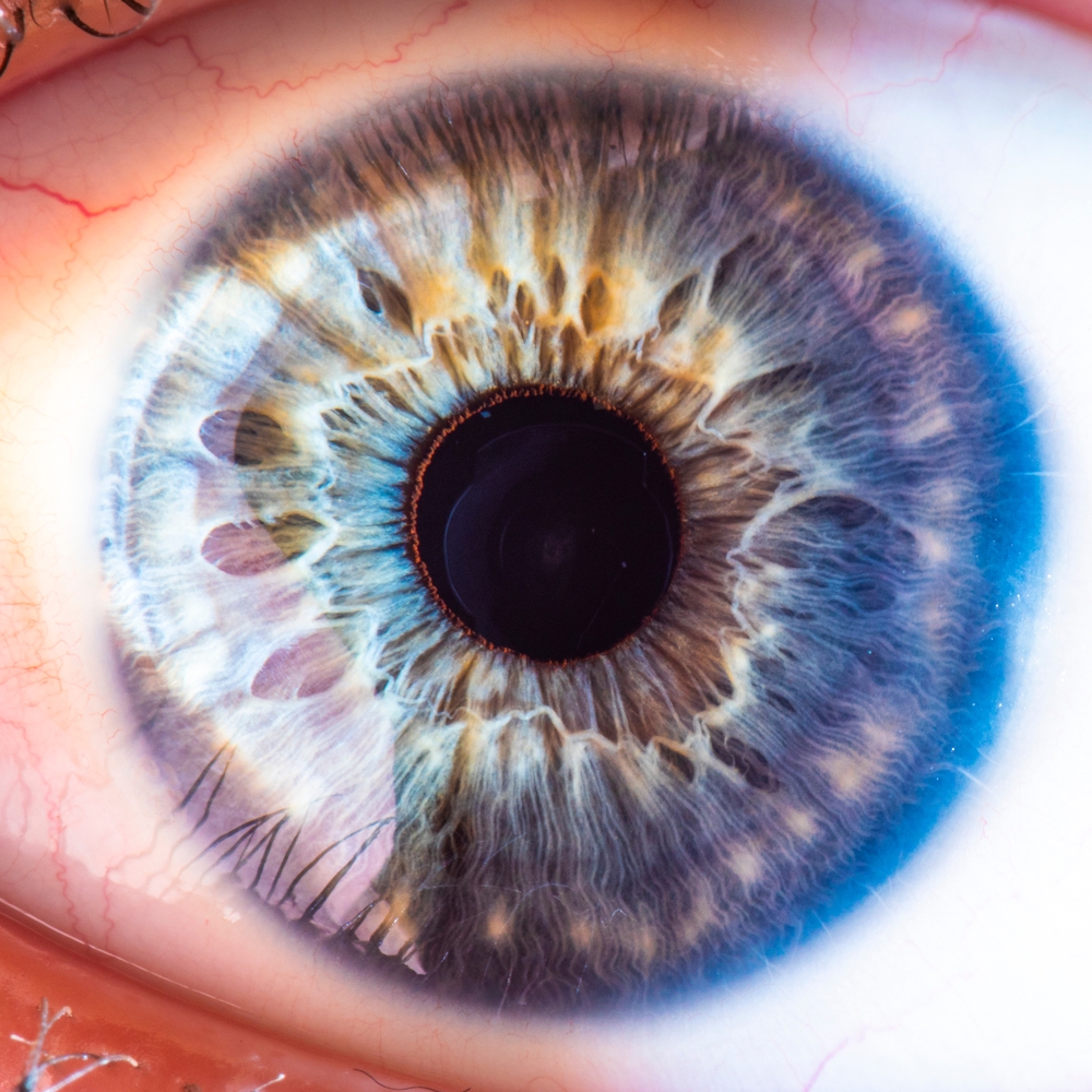 Iclとレーシックの違いと名古屋でオススメのicl 対応眼科 Various Diseases 3