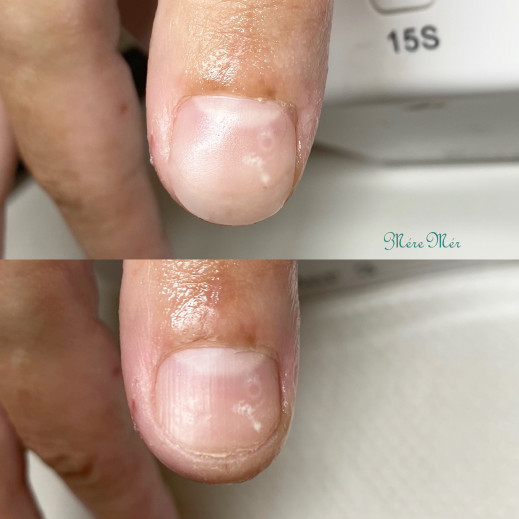 埼玉県 和光市 東京 池袋 深爪専門ネイルサロンmeremerpetit メールメールプチ 深爪 の記事一覧 ページ4